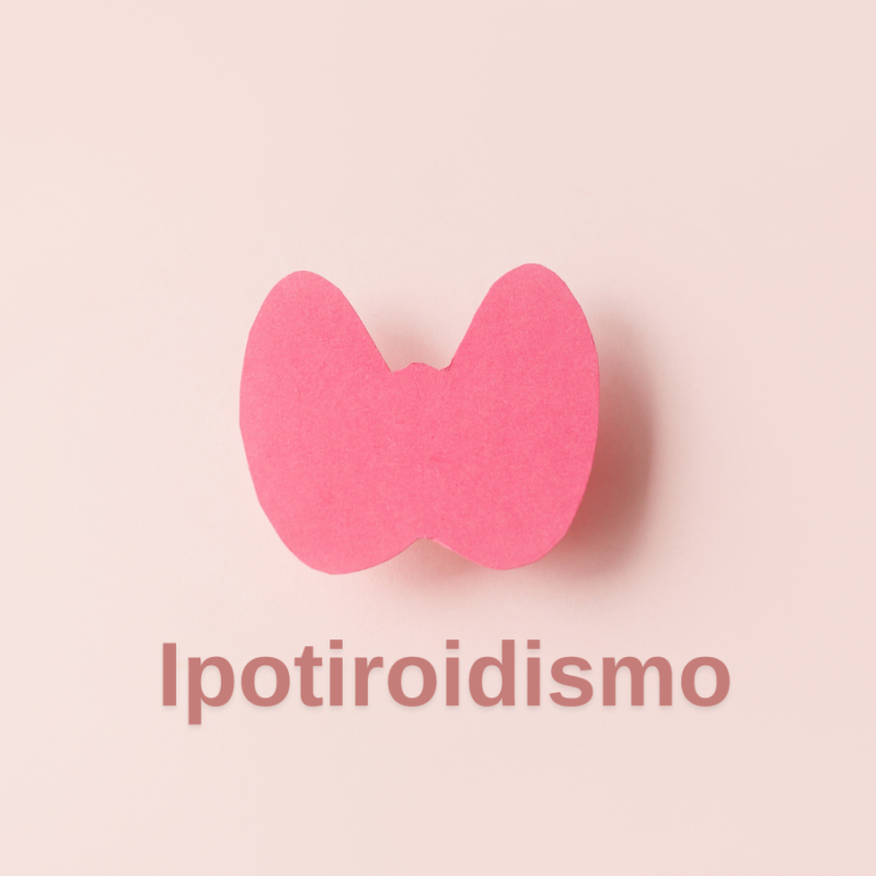 Ipotiroidismo Subclinico: Quando Trattarlo? Diagnosi: L'ipotiroidismo subclinico è una forma iniziale della malattia, con TSH alto e FT4 nella norma. Cause: Spesso è legato a processi autoimmuni come la tiroidite di Hashimoto. Esami del Sangue: Il monitoraggio costante è essenziale per valutare l’evoluzione della patologia. Terapia: Il Dottor Mingardi offre un approccio personalizzato per stabilire quando intervenire con la terapia ormonale.